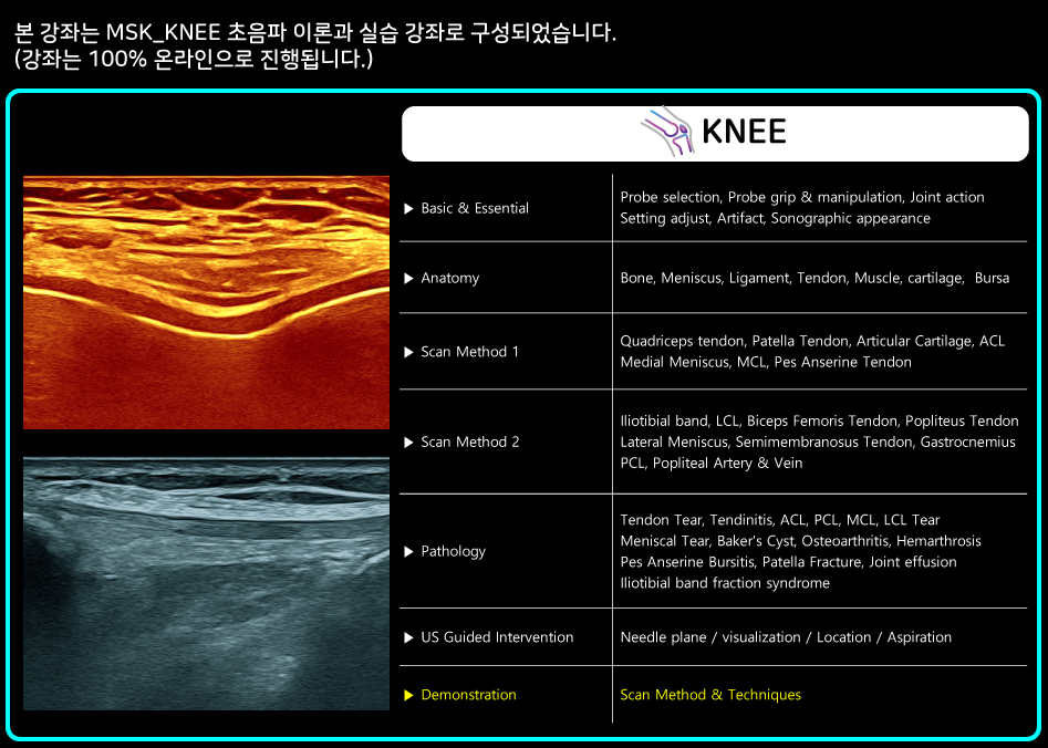 Knee-PKG.jpg