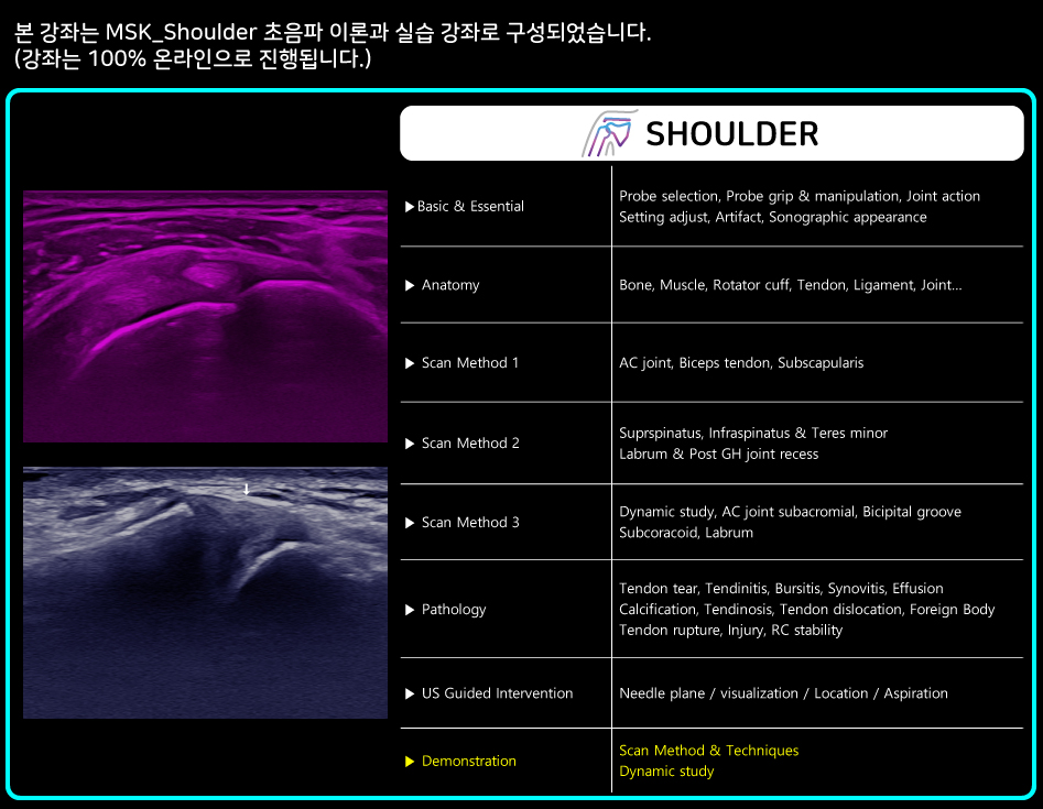 Shoulder-PKG.jpg